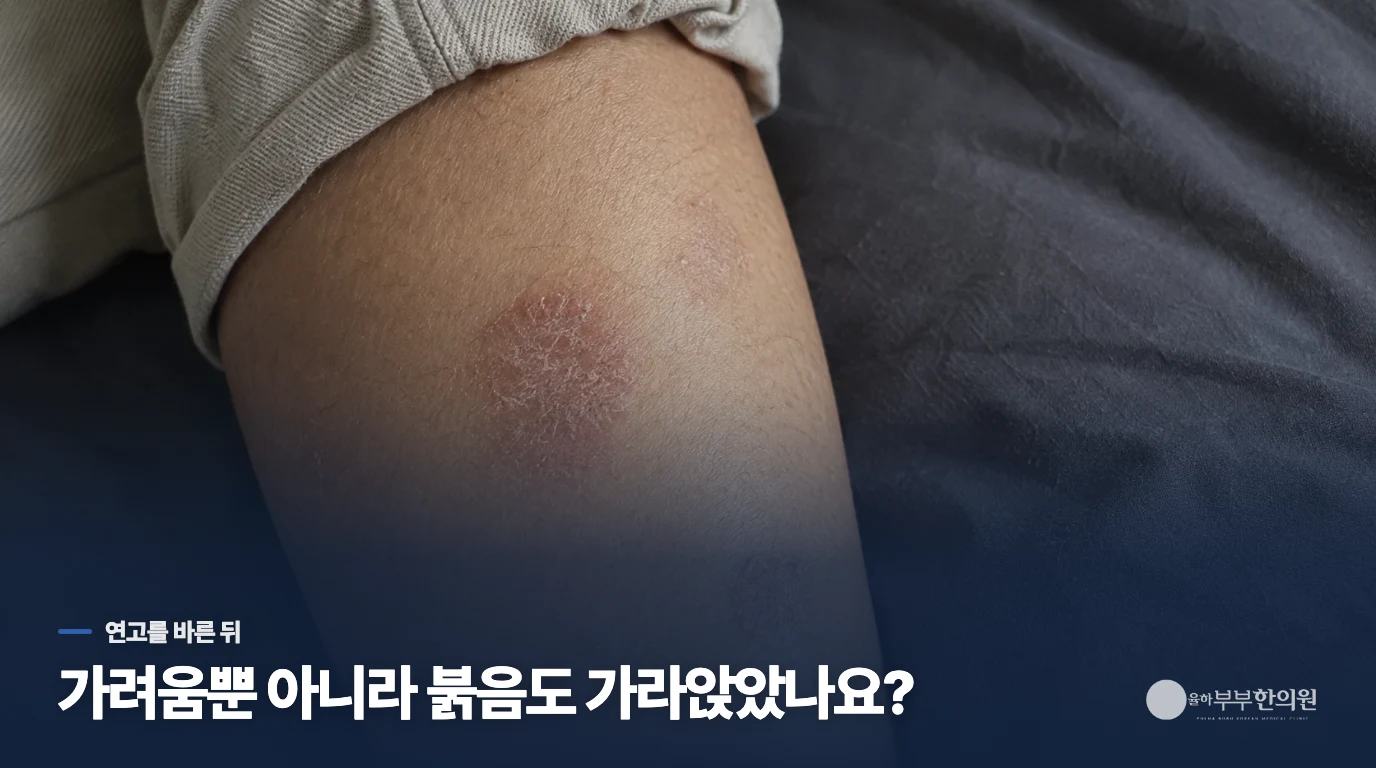 연고를 바르고 덜 가려웠는데, 반점도 가라앉았나요?