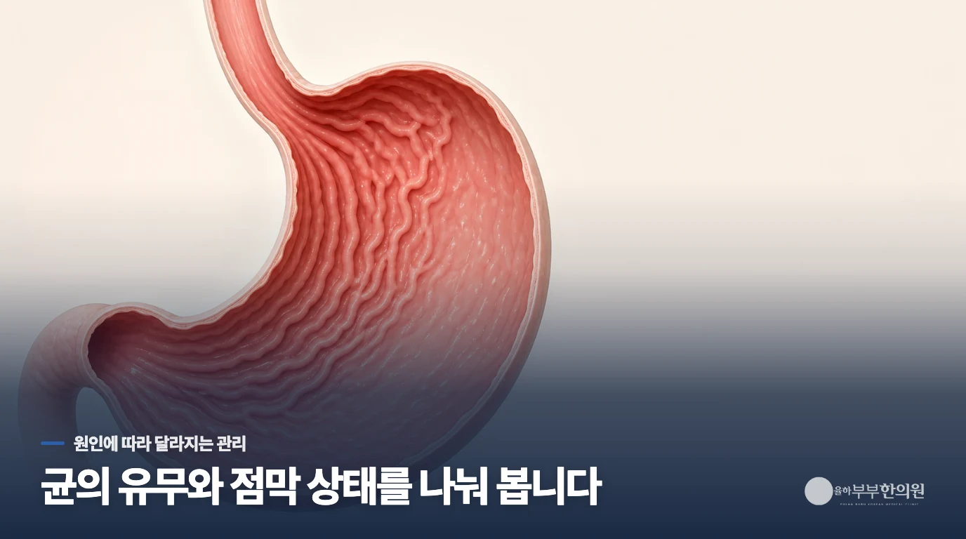 헬리코박터 파일로리와 자가면역성 원인을 나눠 봅니다