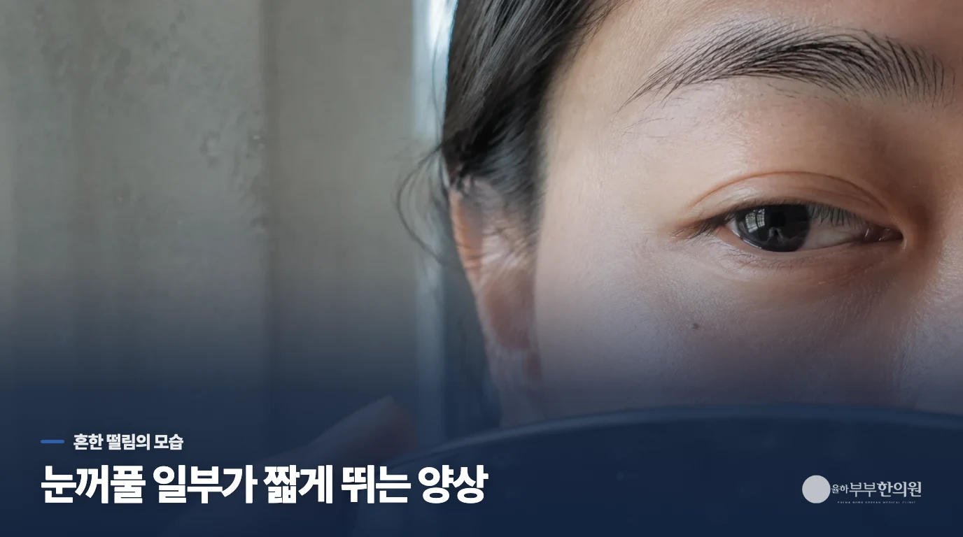 눈꺼풀 일부만 짧게 뛰는 경우가 흔합니다