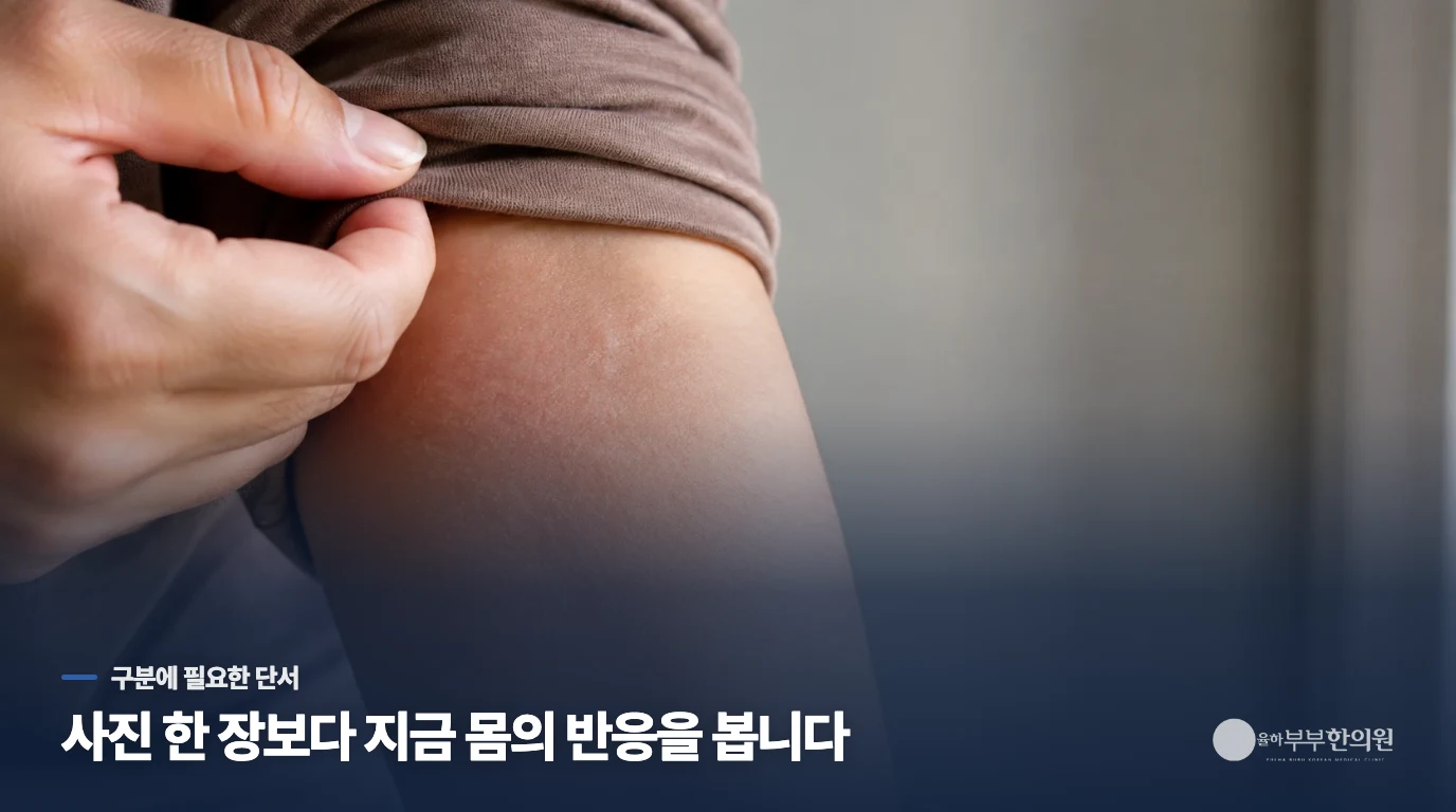 오늘 보인 점은 사진 한 장과 압박 반응으로 비교해 보세요