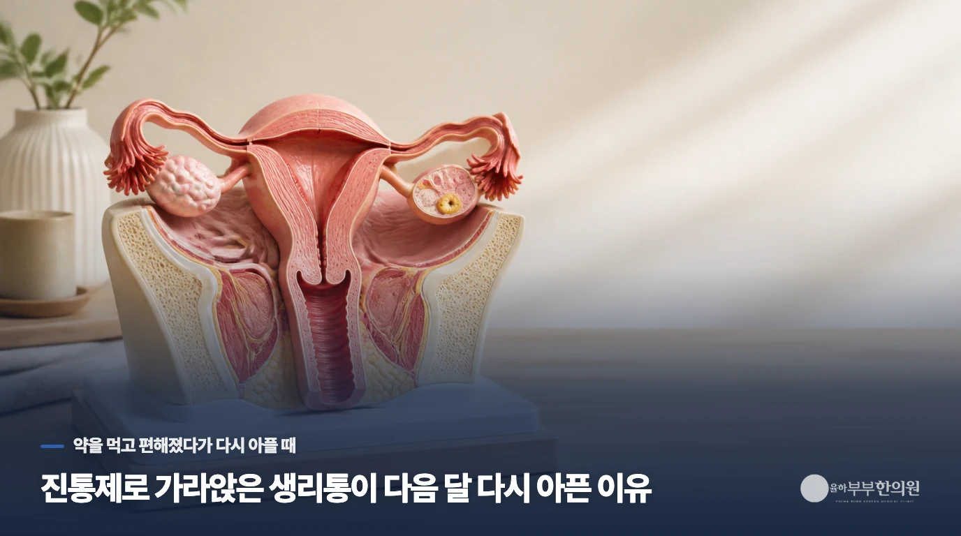 진통제로 가라앉은 생리통이 다음 달 다시 아픈 이유