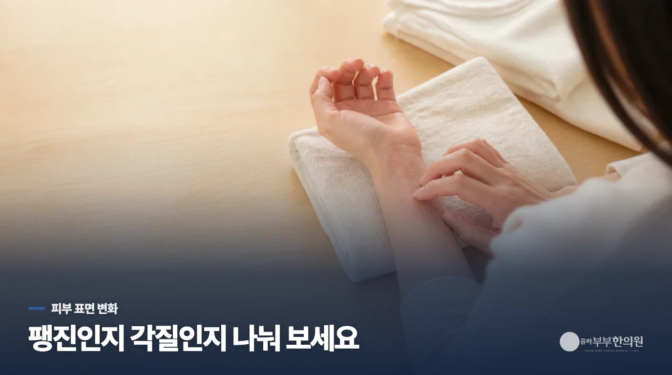 가려움만이 아니라 화끈거림과 피부 표면도 살핍니다