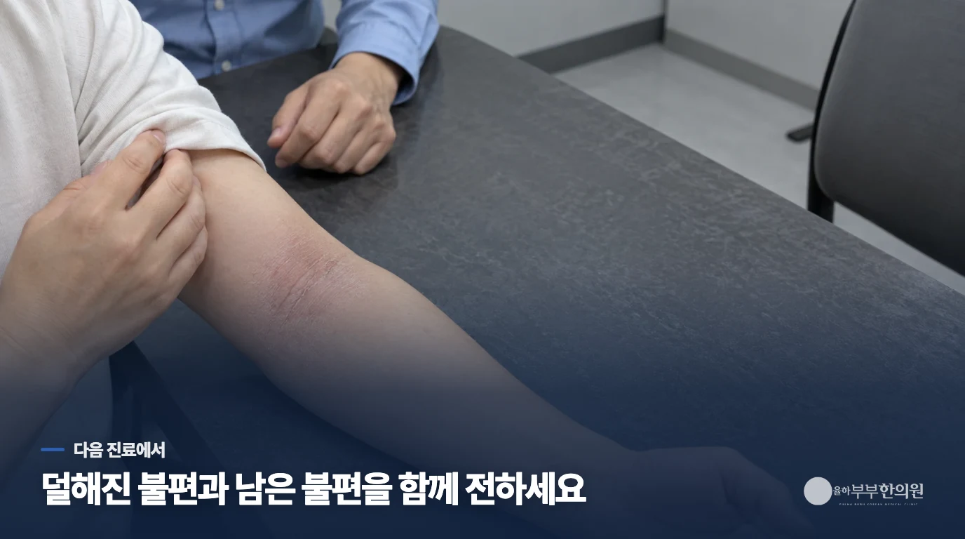 따가움과 가려움이 반복될 때는 피부 모습도 함께 보세요