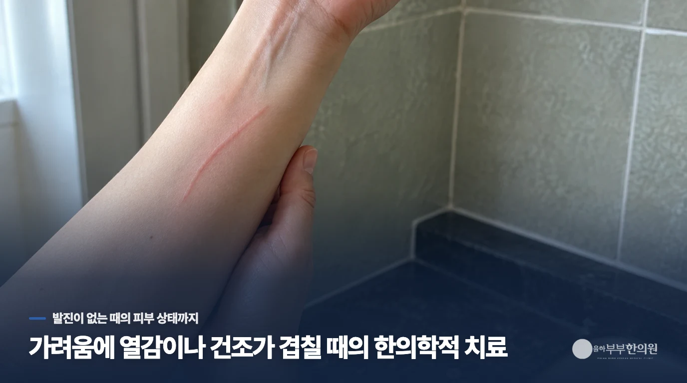 가려움에 열감이나 건조가 겹칠 때의 한의학적 치료