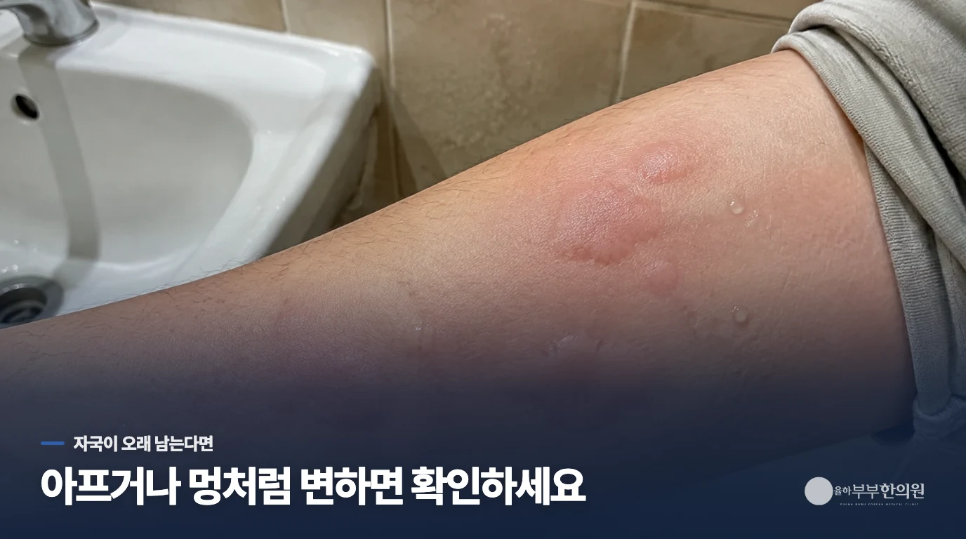 같은 자국이 남거나 붓는 부위가 달라질 때