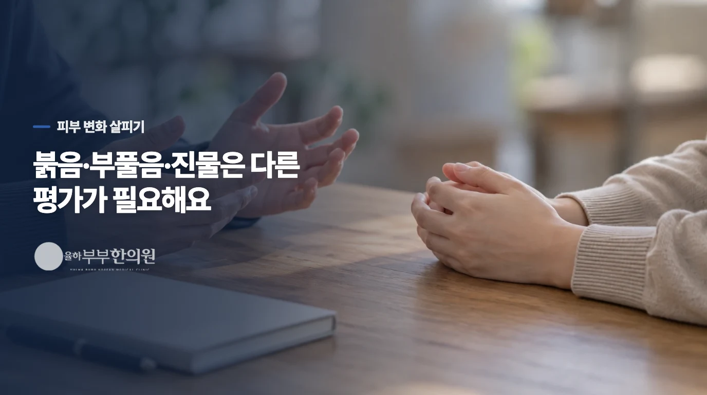 붉은 발진이나 진물이 있으면 보습만으로는 부족할 수 있습니다