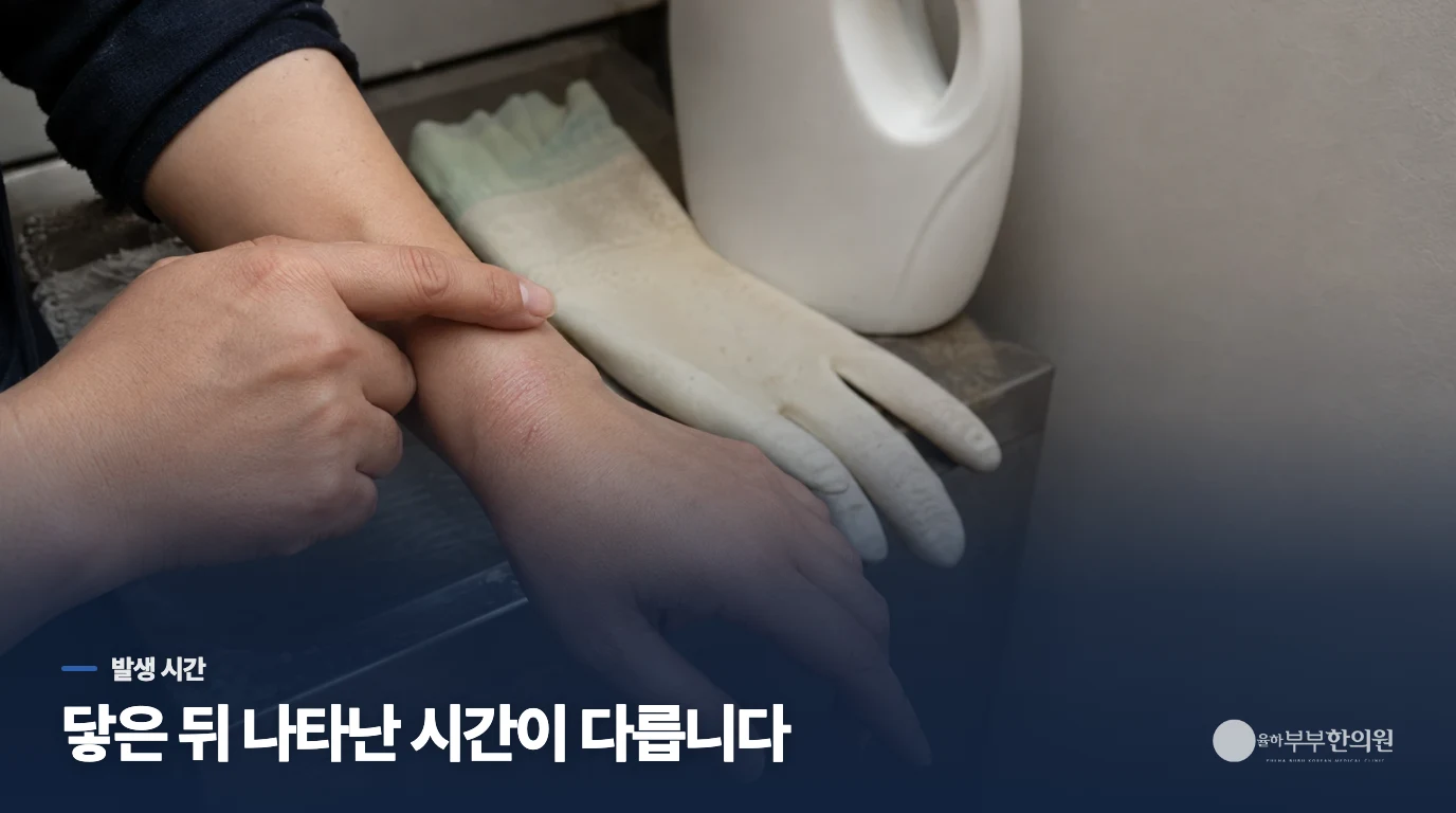 닿자마자 부풀었나요, 몇 시간 뒤 거칠어졌나요?