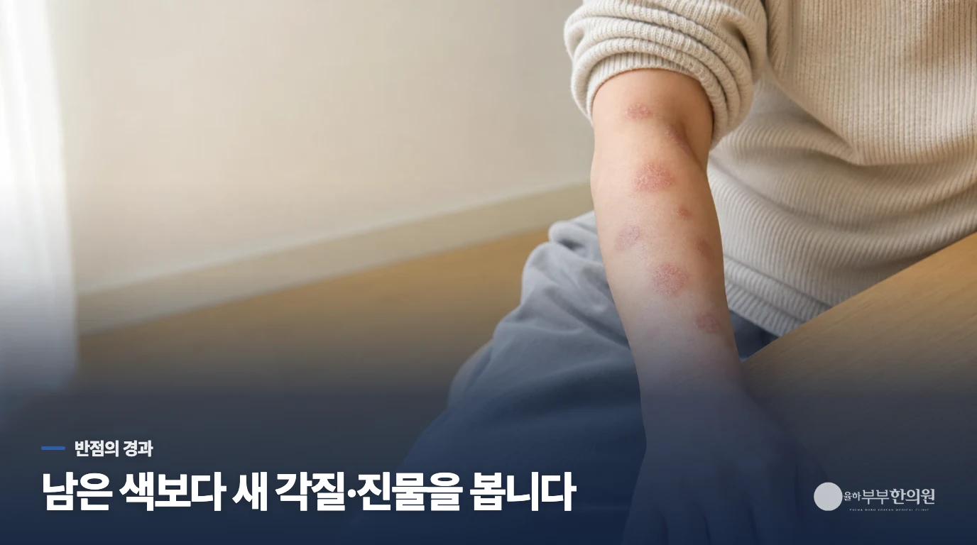 갈색 자국만 남았나요, 다시 긁히는 반점이 생겼나요?