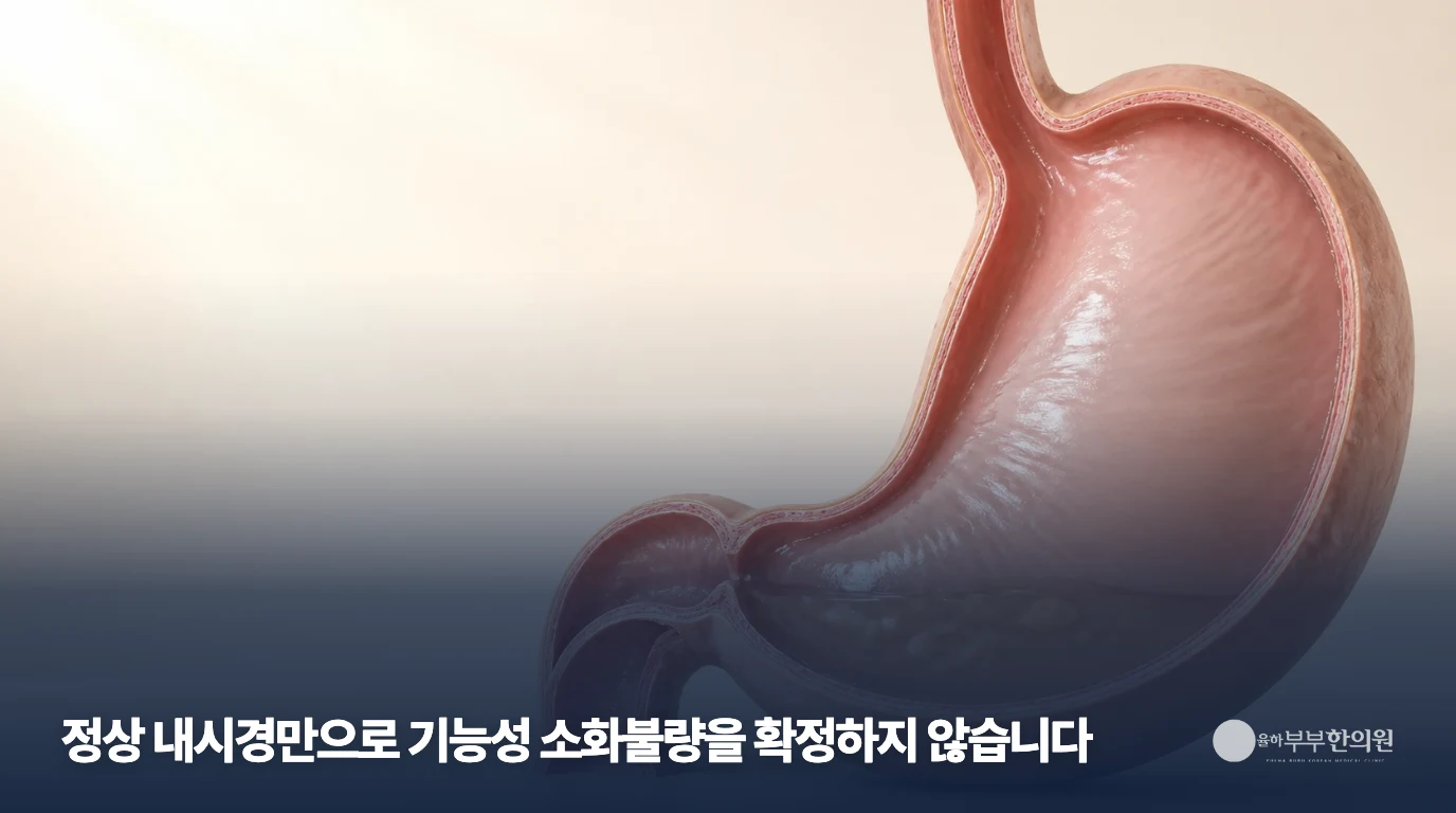 위의 내부 구조를 나타낸 설명 그림
