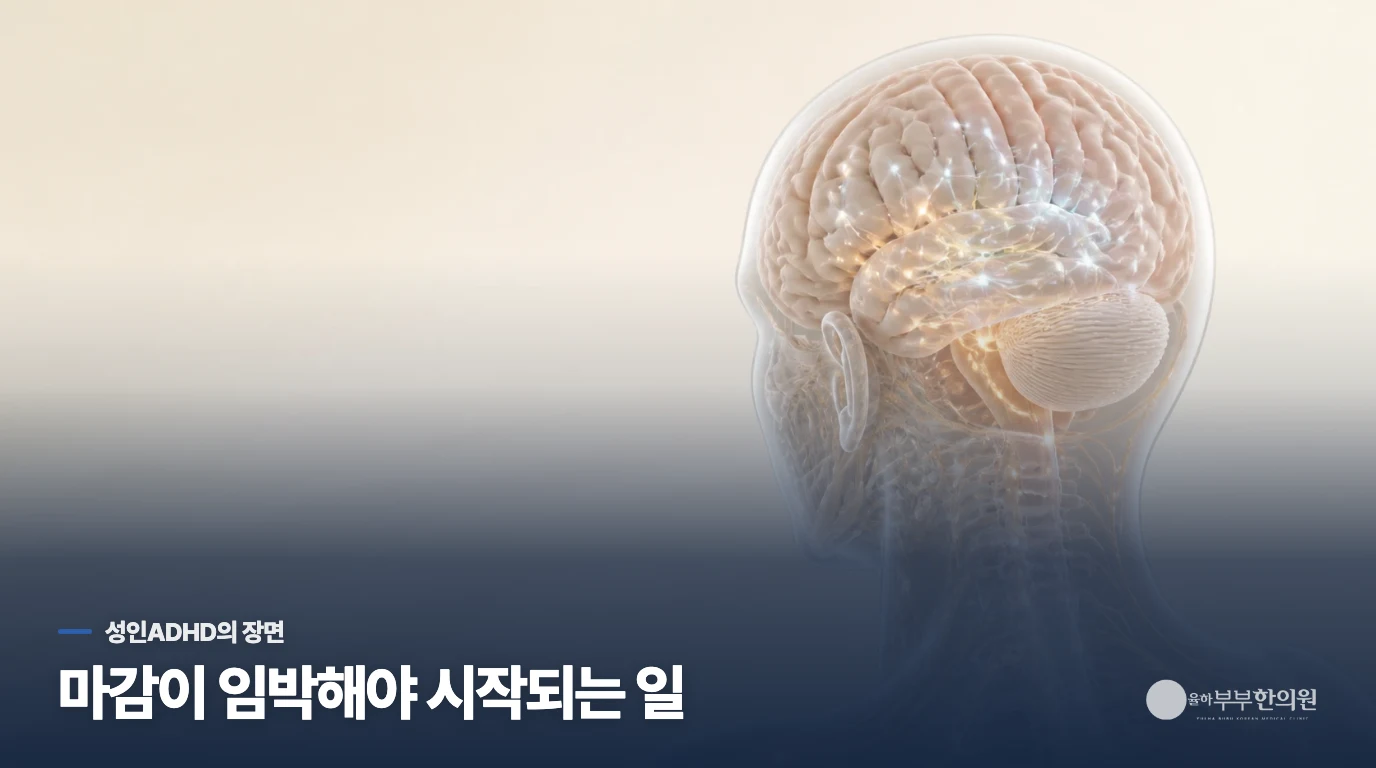 마감이 가까워져야 손이 움직이는 이유